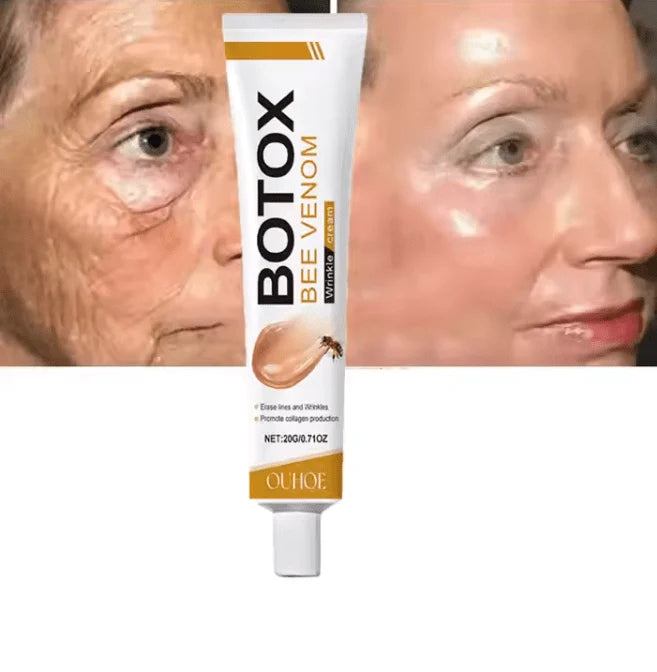 Botox Wrinkle Cream